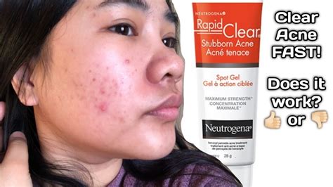 Spot clearing magic powder for acne
